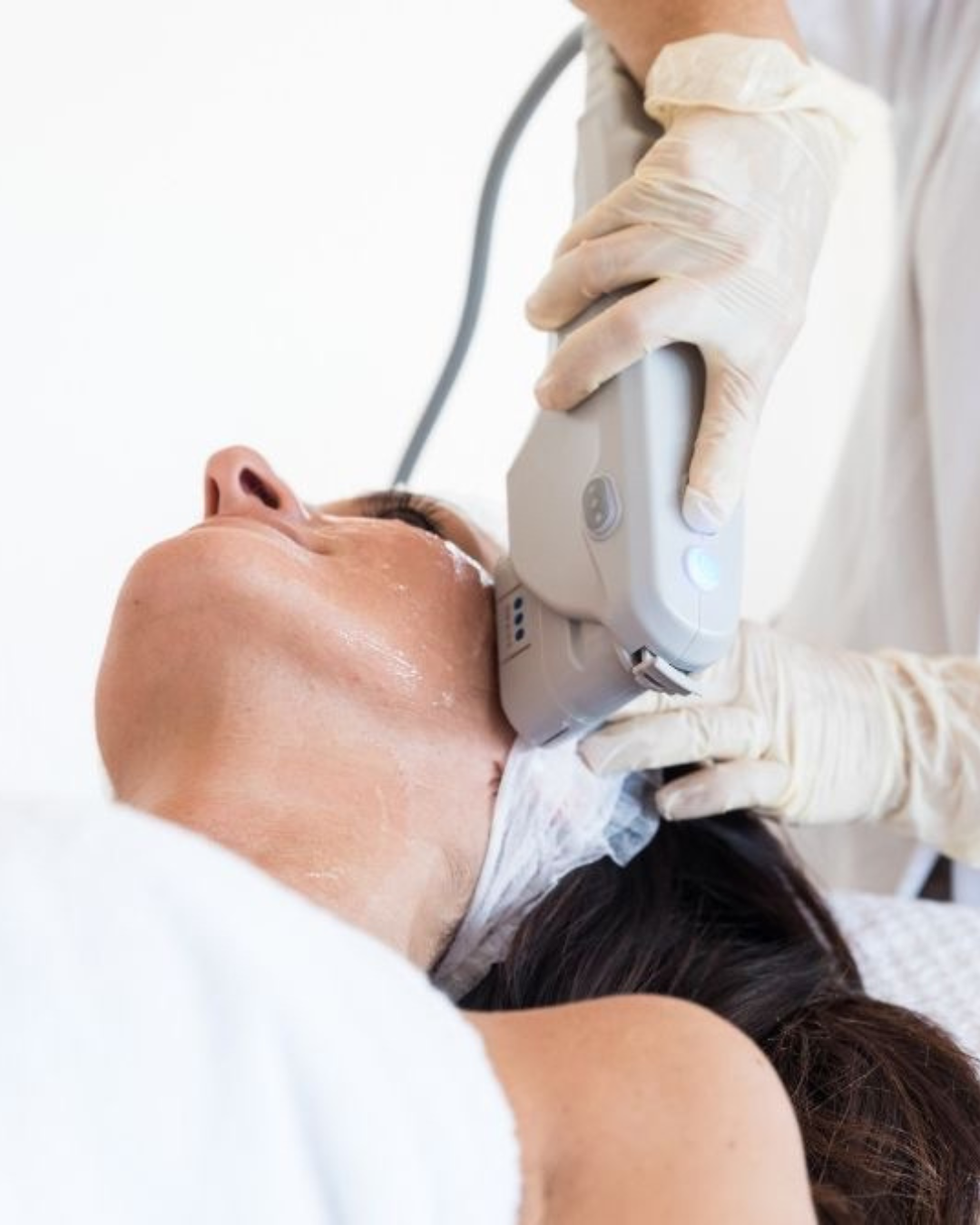 HIFU facial y corporal