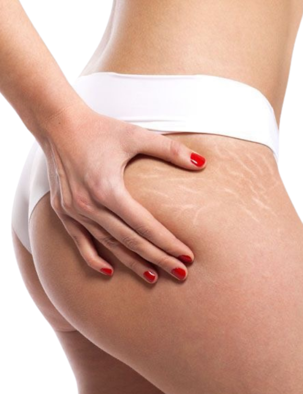 Evi Alves — Tratamiento