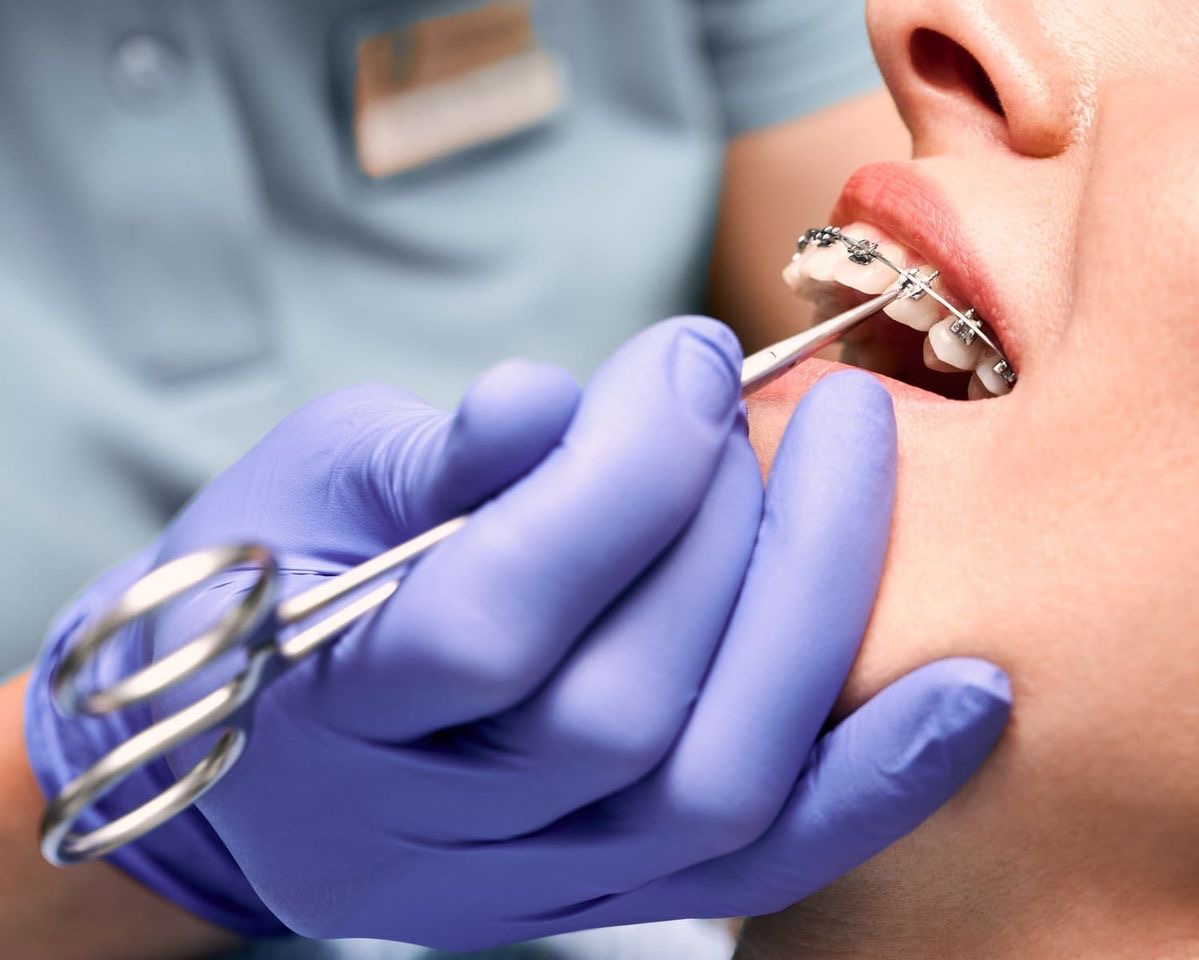 Ortodoncia OyE Dental La Reina