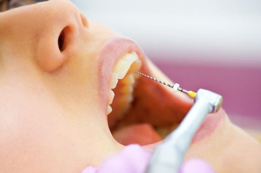 Endodoncia OyE Dental La Reina