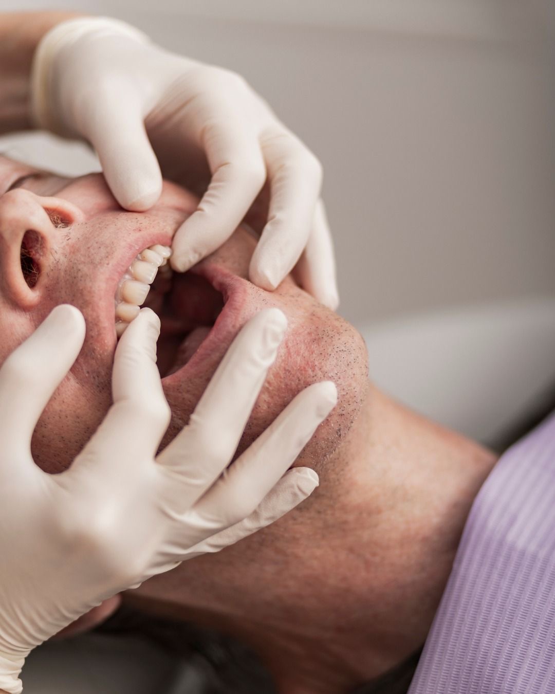 Prótesis dental OyE Dental La Reina
