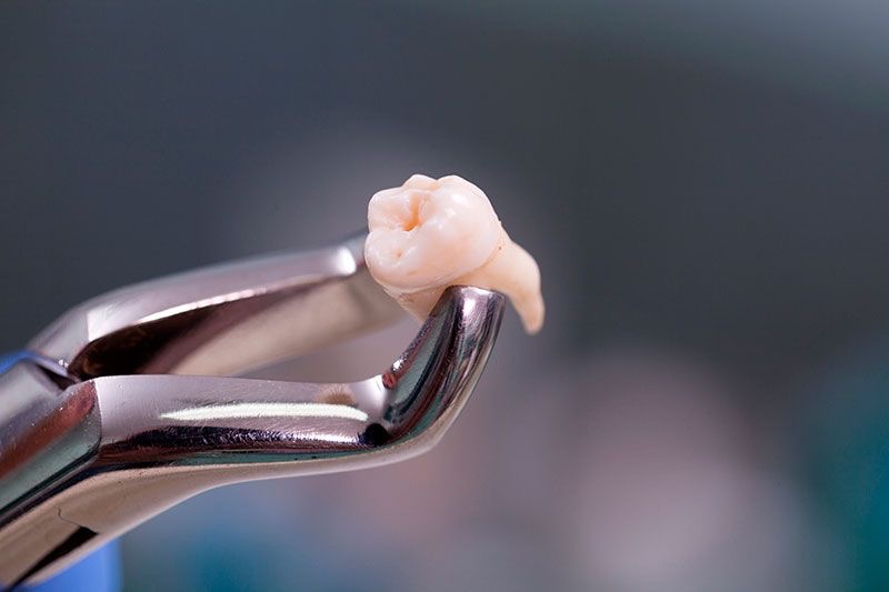 Cirugía Oral OyE Dental La Reina