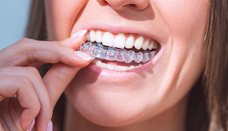 Woman holding invisalign