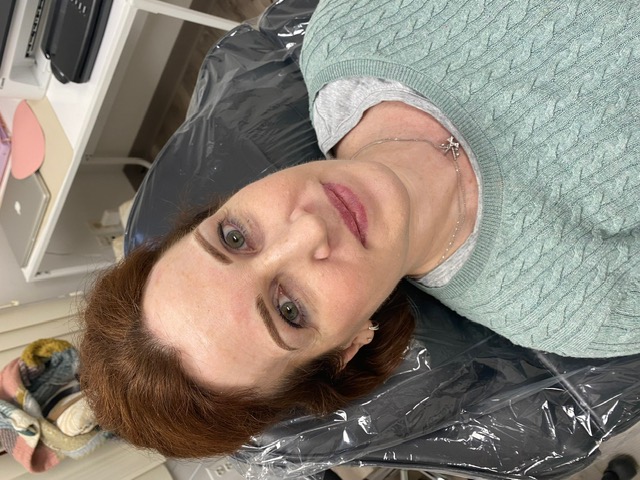 Brows · Before & After — OHM Studio