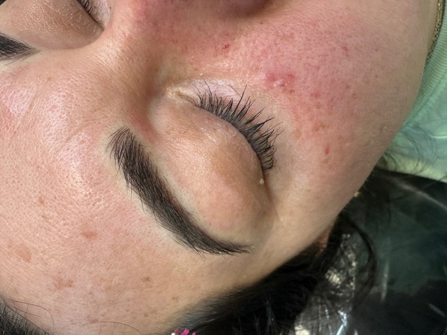 Brows · Before & After — OHM Studio