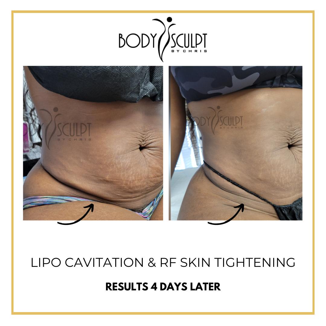 Body Sculpt by Chris - Business Photo