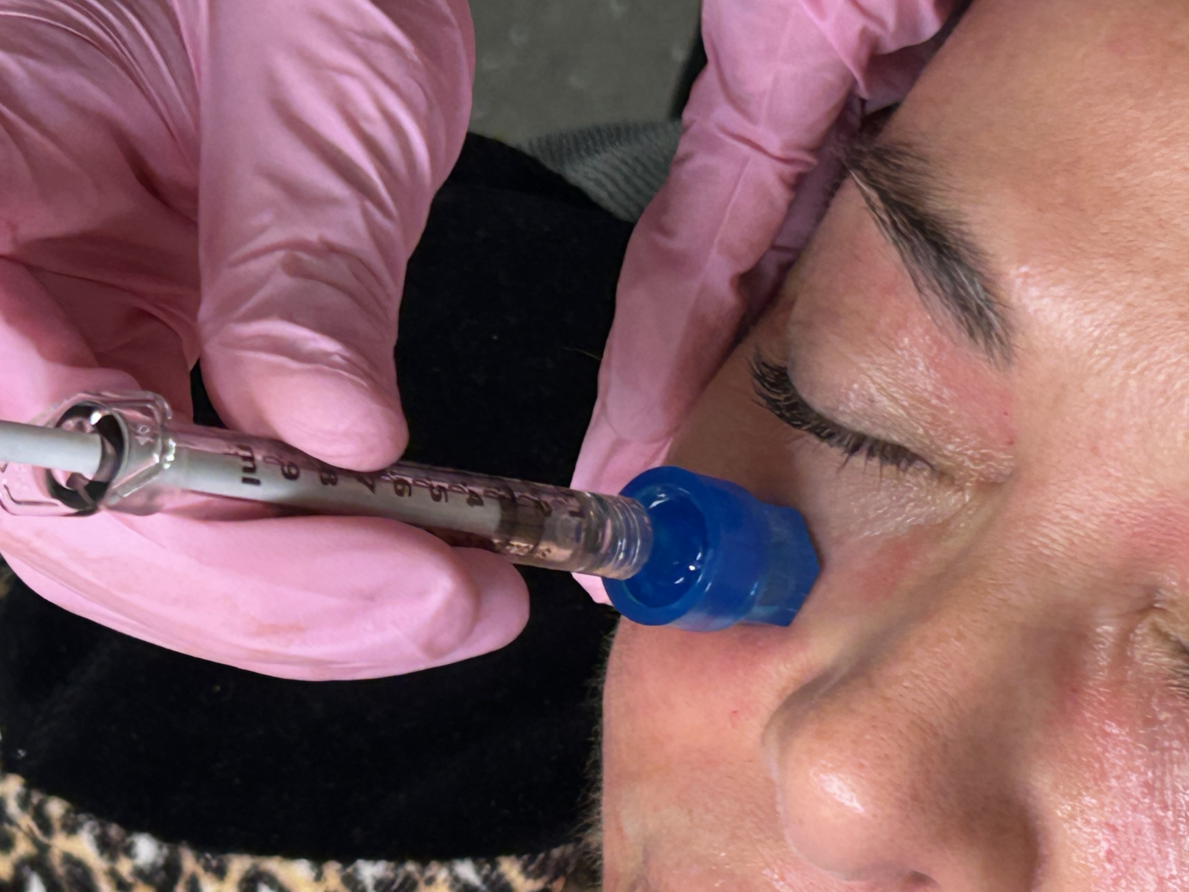 Mermaid Facial 
