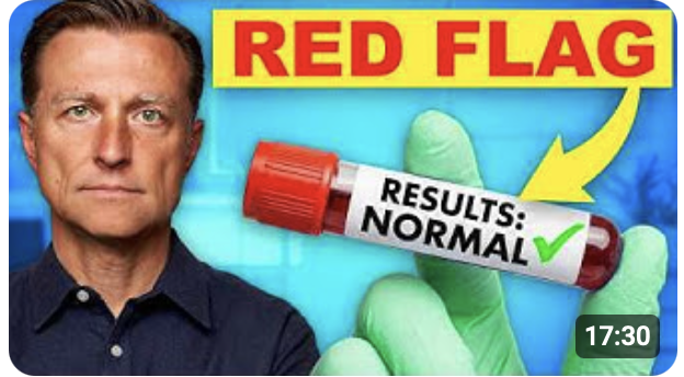 Thumbnail example