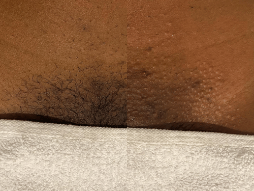 Dark Spot Correction Treatment Jacksonville