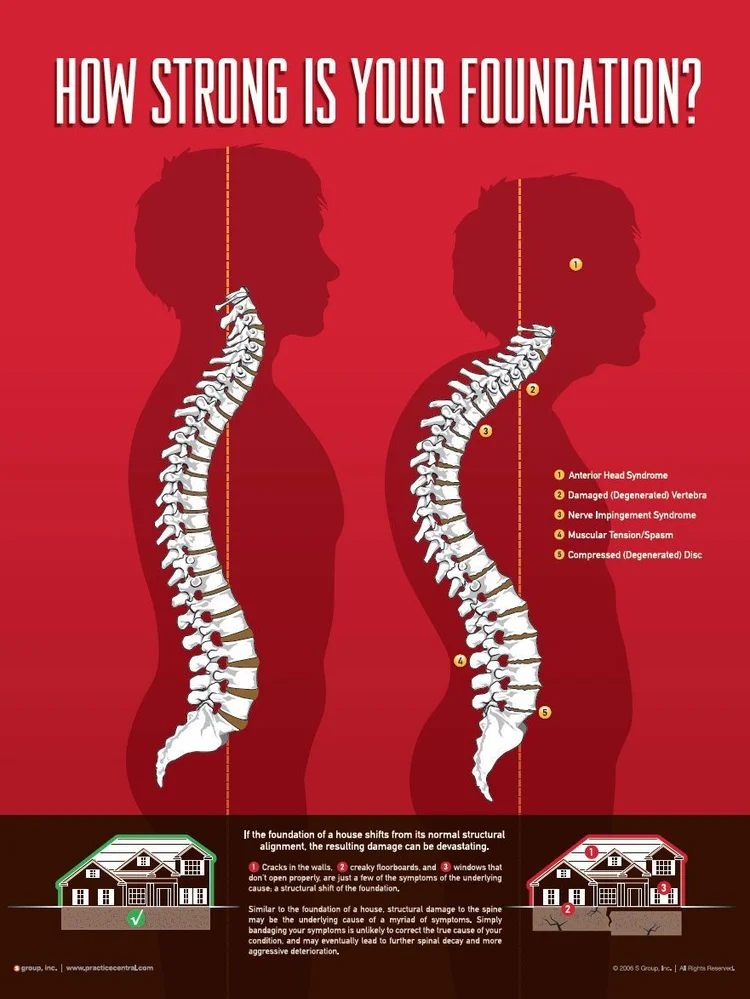 Why posture gets worse with age — centre of mass diagram showing forward head and rounded spine — Structural Chiropractic Hastings