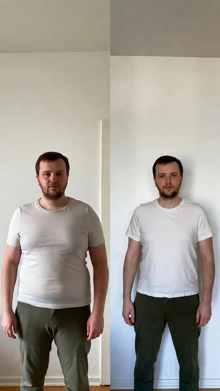 Patient results - before and after oral semaglutide