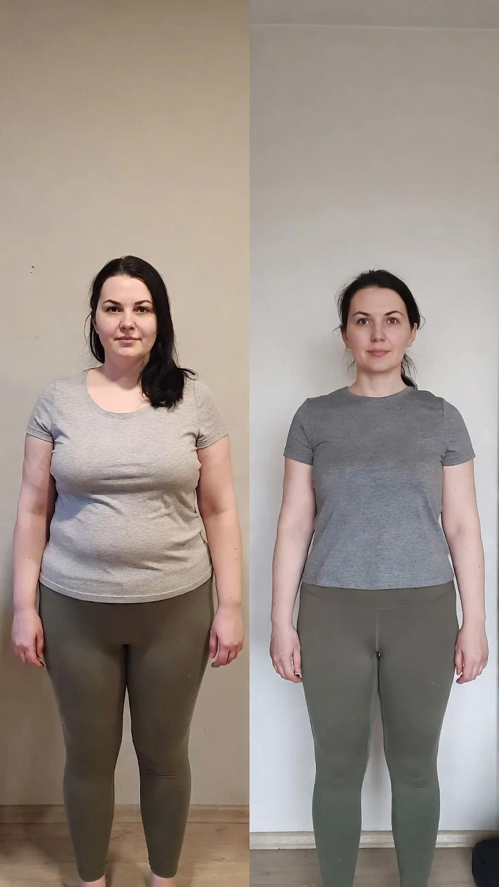 Patient before and after results - oral tirzepatide