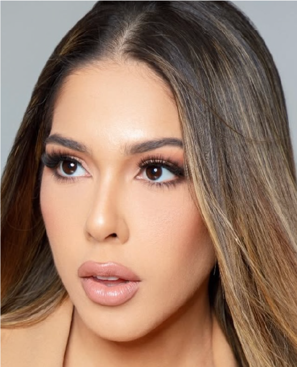 Before and after photos of facial filler treatments at Lumiee Clinic – real patient results from non-surgical procedures in Cartagena.