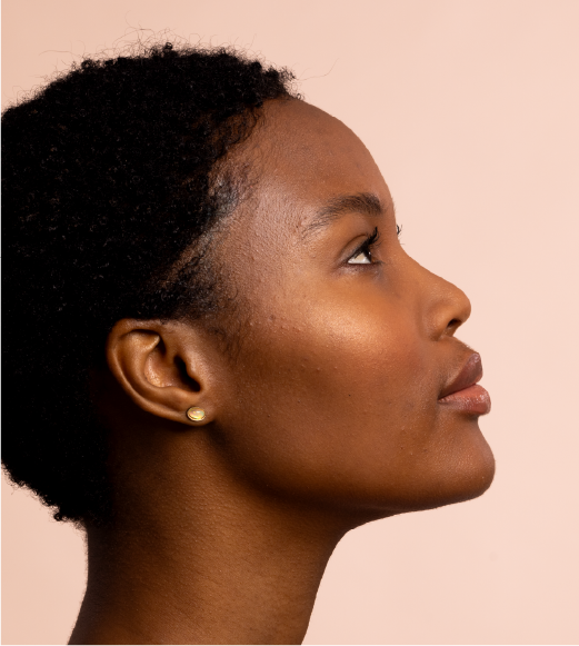 Non-surgical nose reshaping using hyaluronic acid fillers at Lumiee Clinic – safe and effective rhinoplasty alternative abroad.