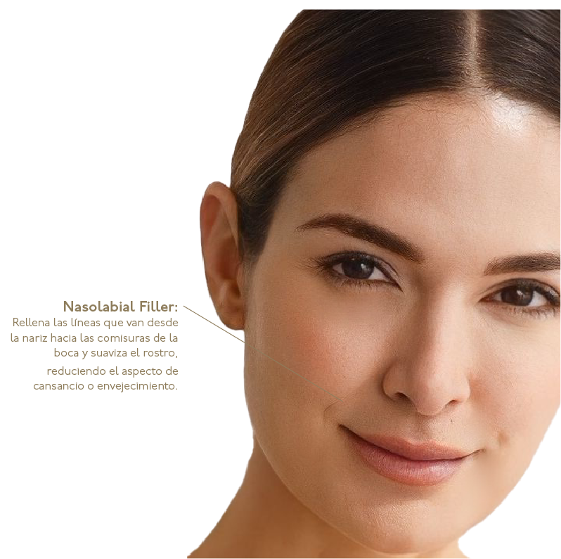 Dermal filler treatment for nasolabial folds at Lumiée Clinic in Cartagena – non-surgical correction of smile lines.