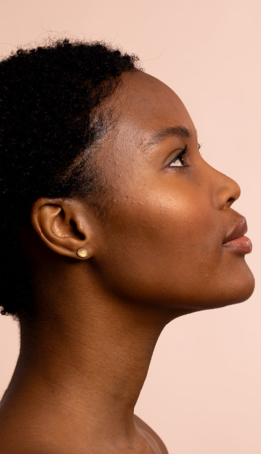 Woman after Full Face aesthetic treatment in Cartagena at Lumiee Clinic – non-surgical facial harmonization with dermal fillers and anti-aging injectables.