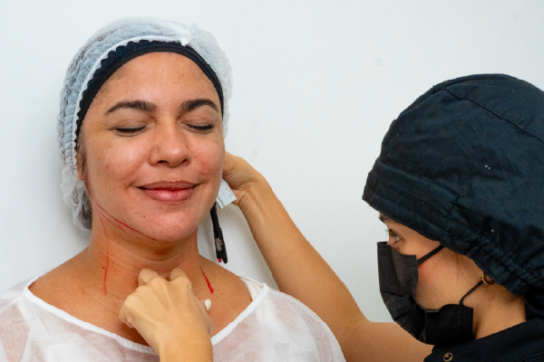 Perfilamiento facial sin exagerar: resultados sutiles y elegantes