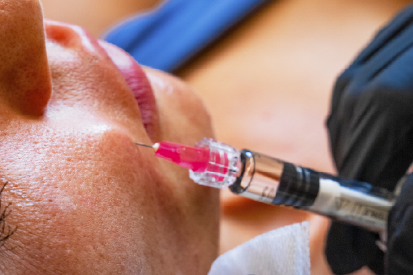 Bioestimulación de colágeno: qué es y por qué es tendencia