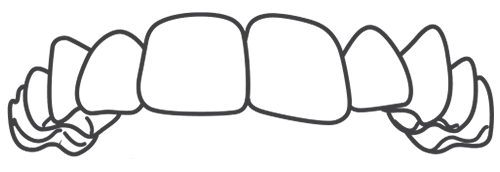 Align Misshapen Teeth