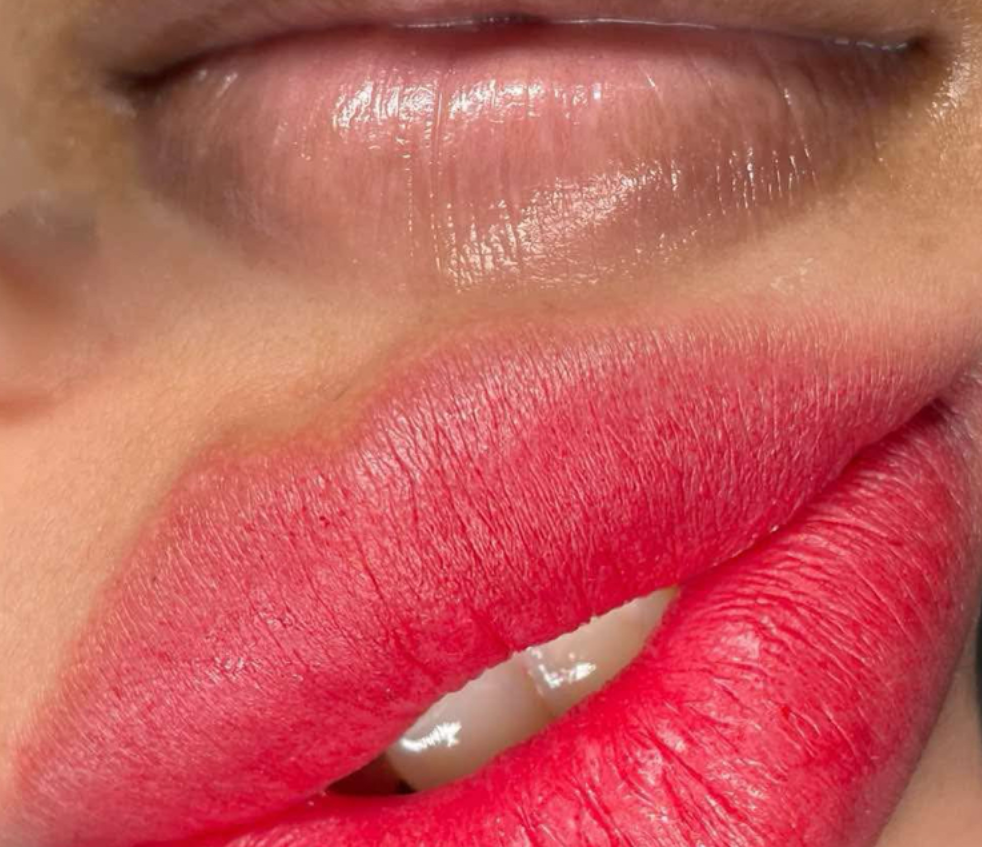 Rebolip - Dark Lip Correction