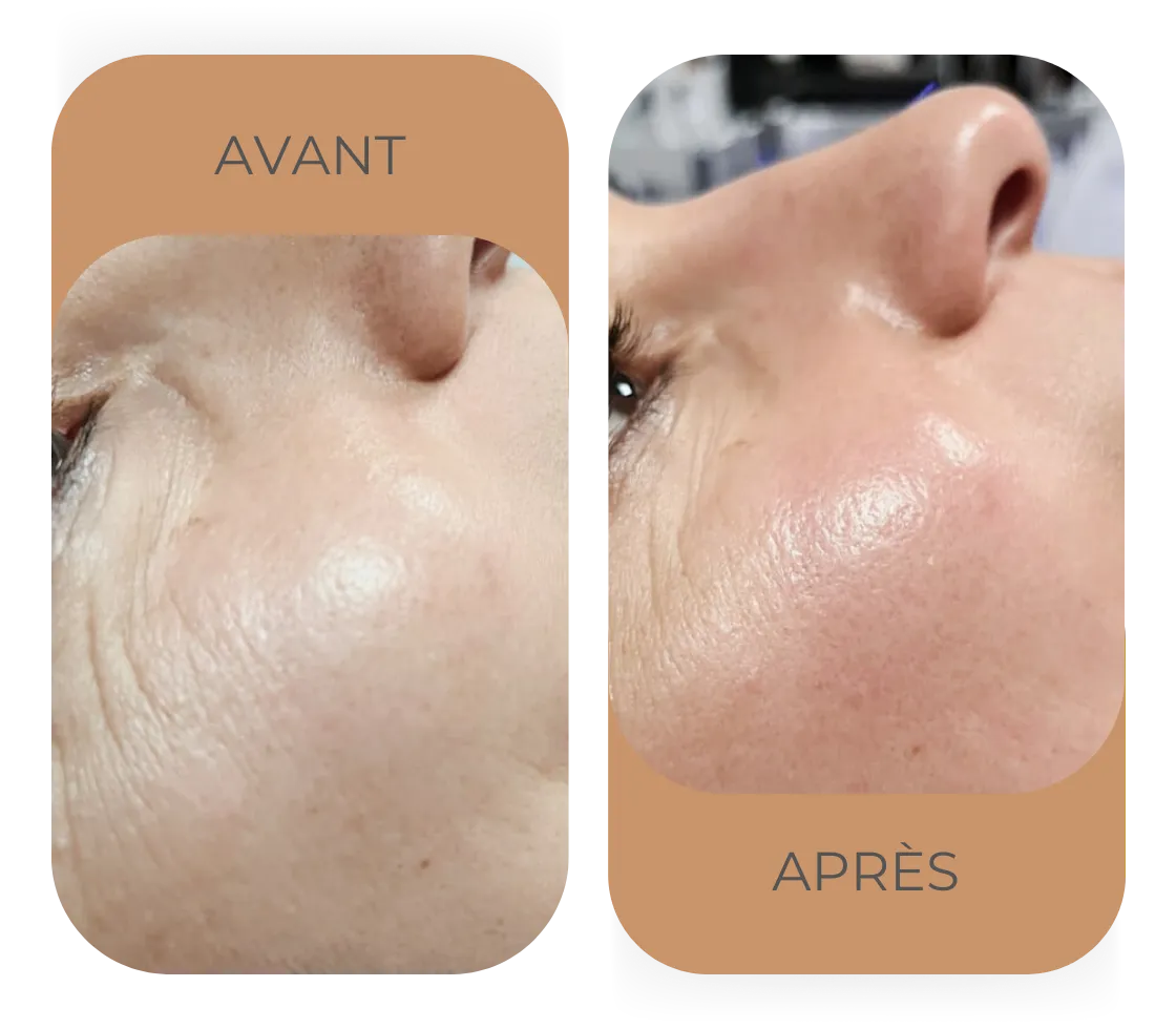 Résultat Bio Minceur 3