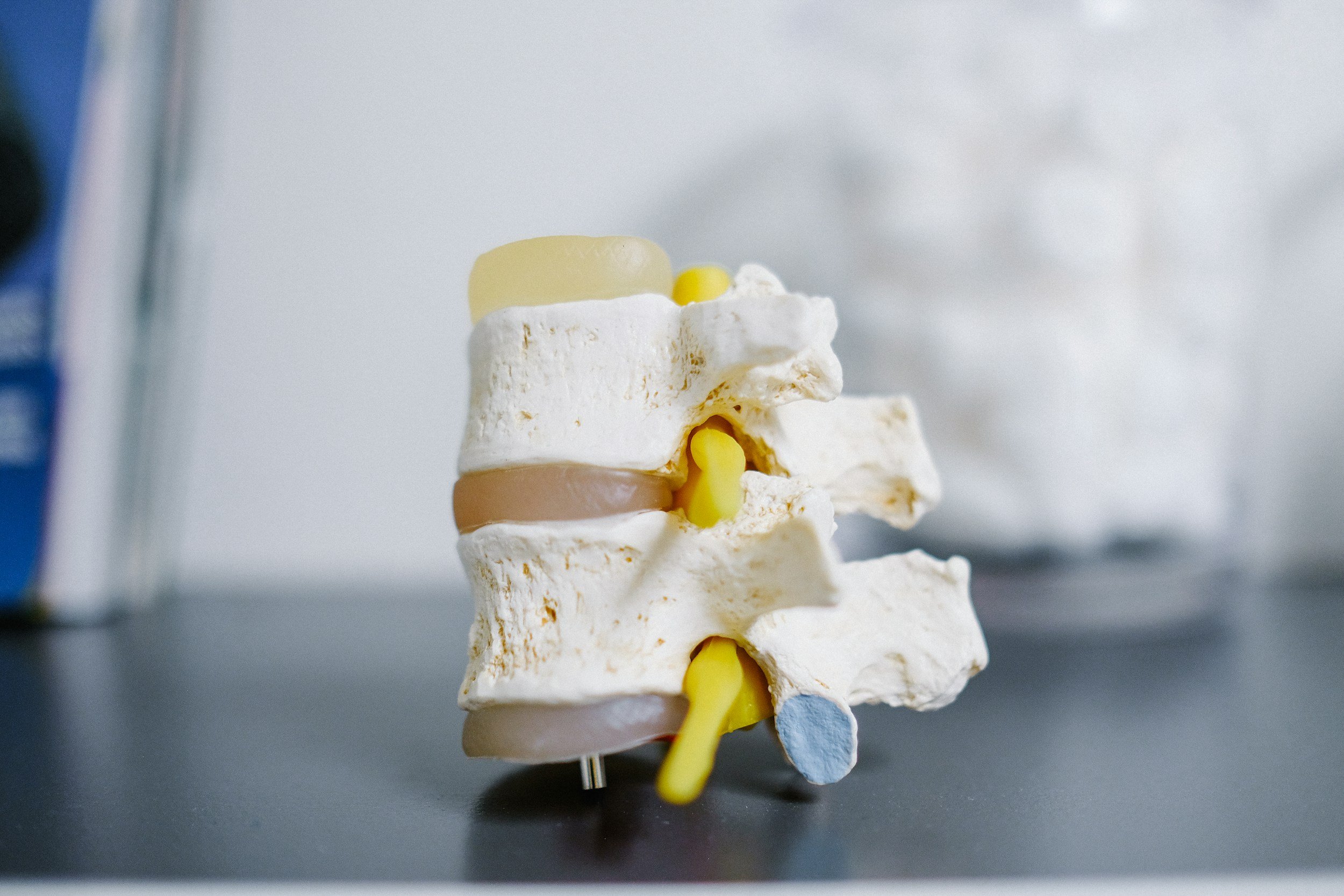 A miniature model of a human spine made of white and beige materials with yellow accents, set against a plain background.