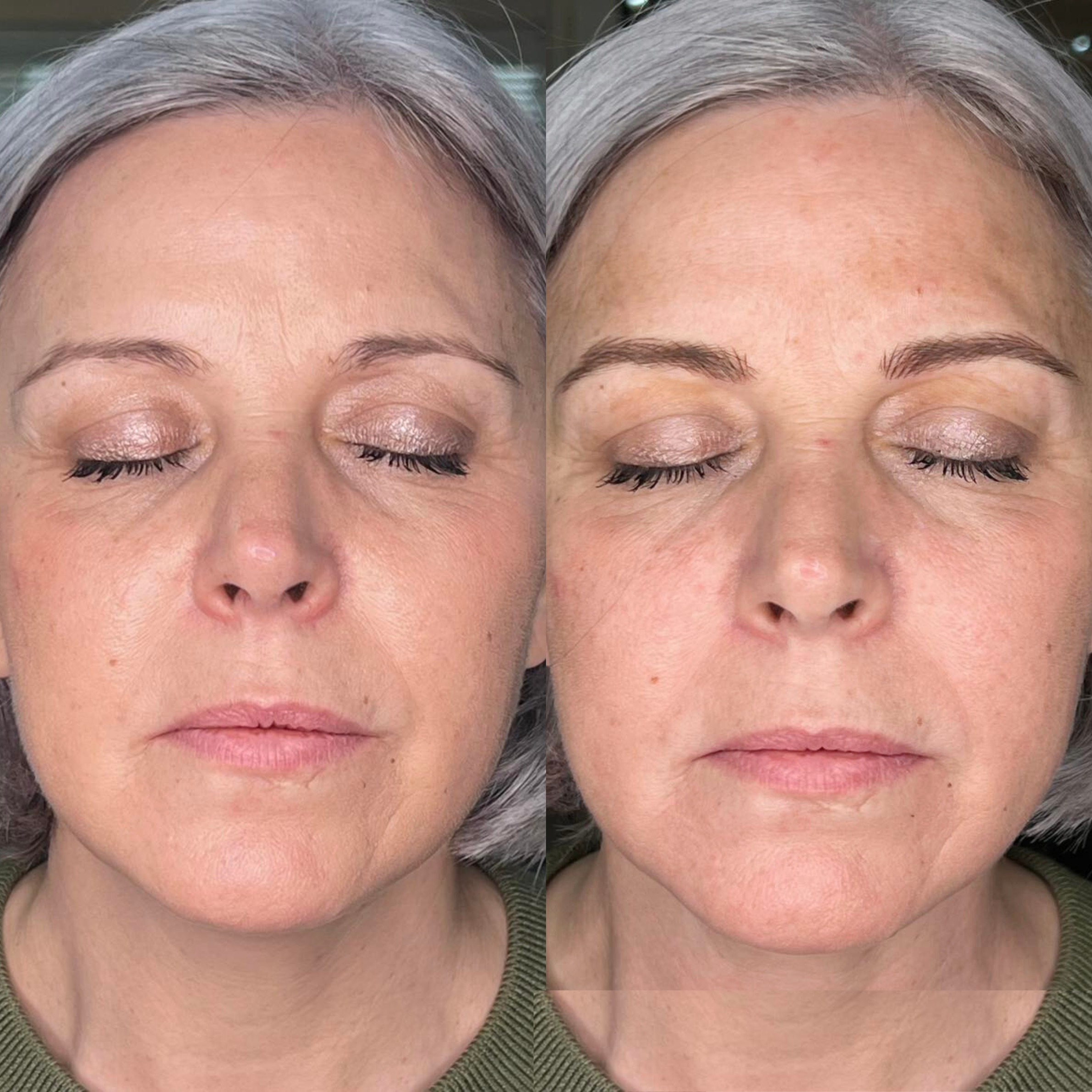 Lip blush permanent makeup result – Rebecca PMU Cornwall