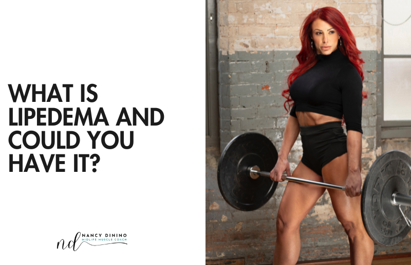 What Is Lipedema and Could You Have It?
