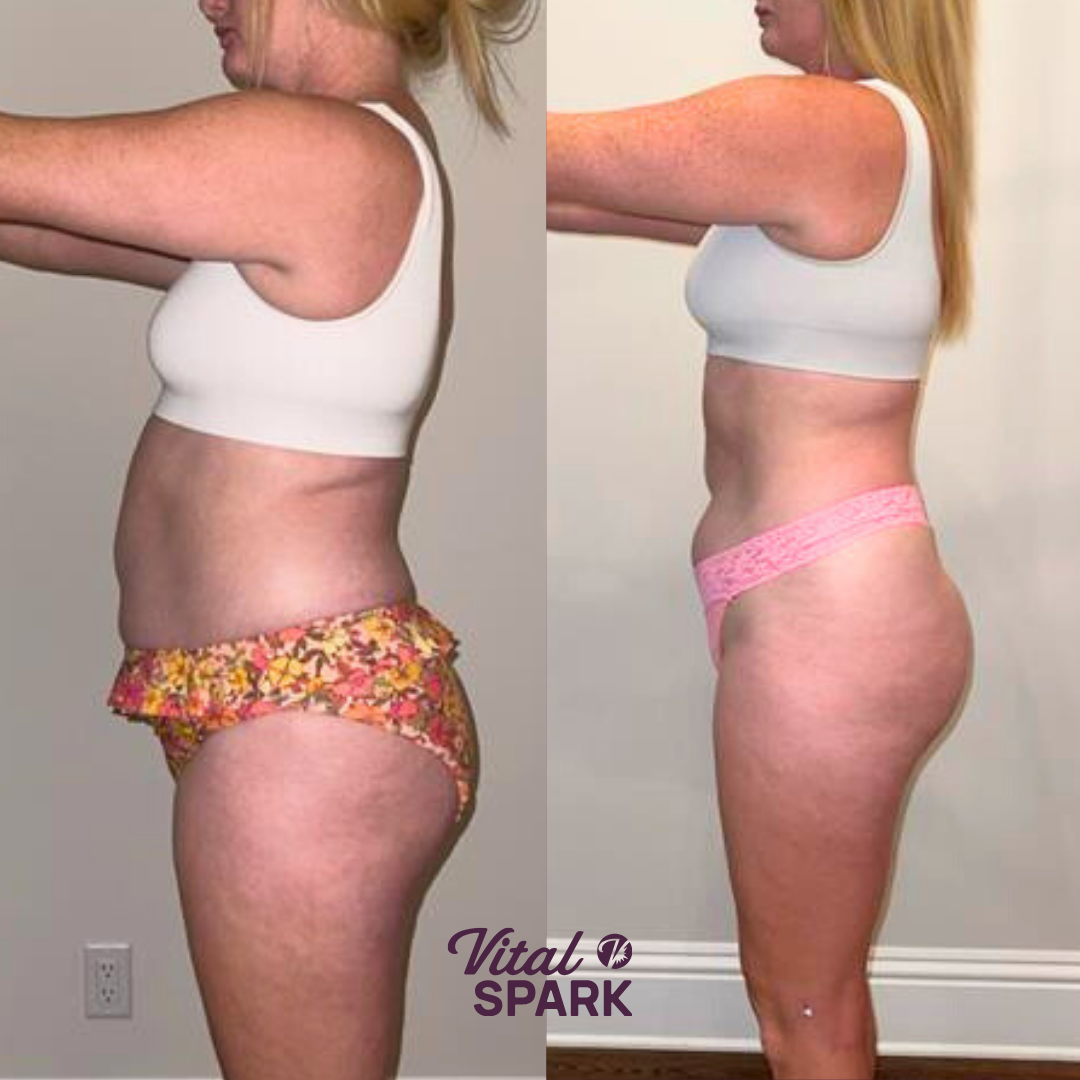 Vital Spark Coaching client transformation