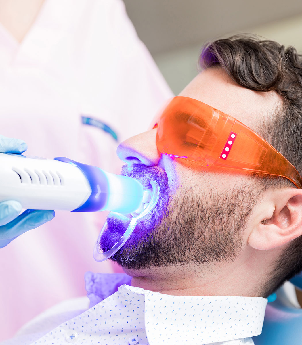 Clear Ceramic Braces