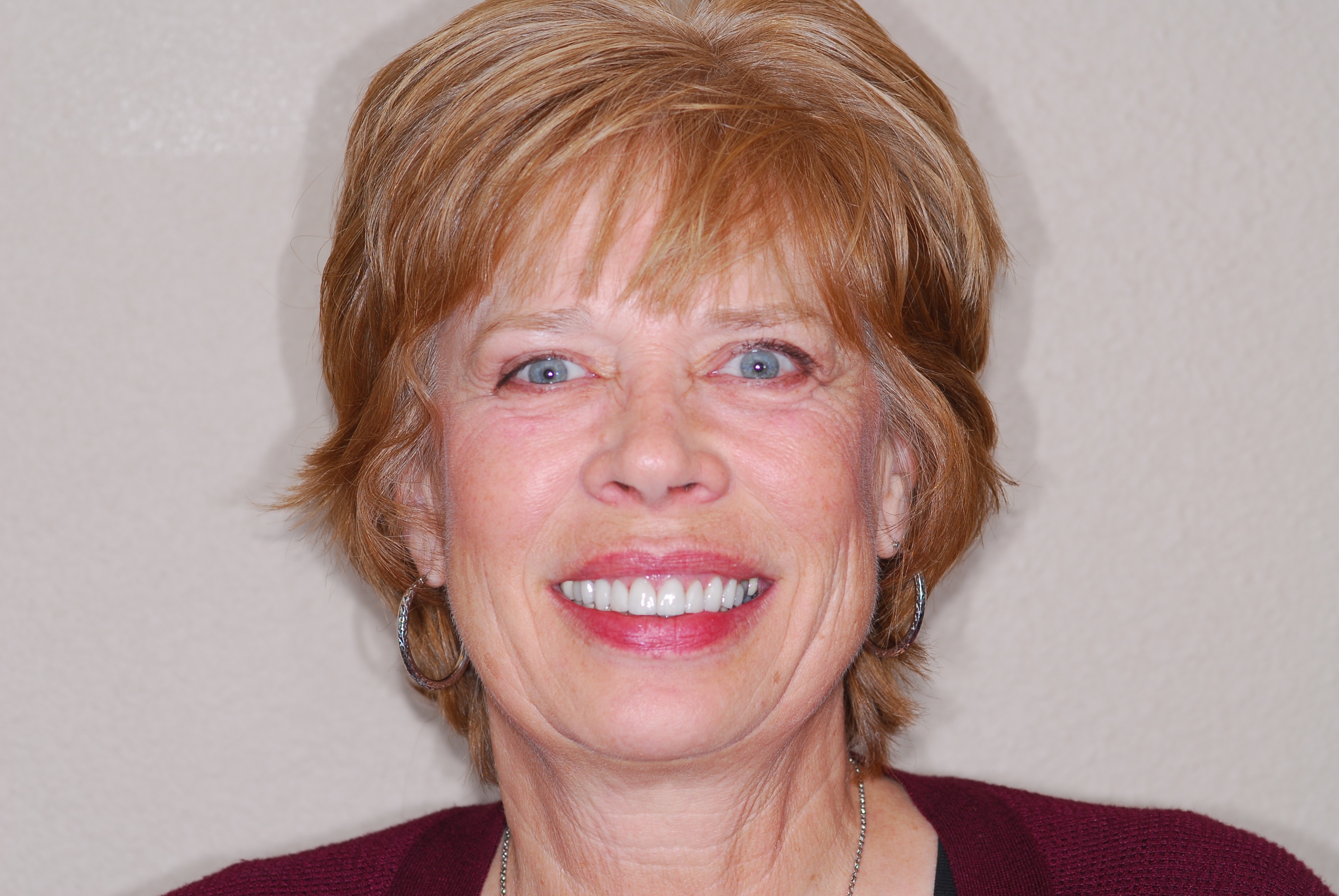 Patient smile after dental implant treatment