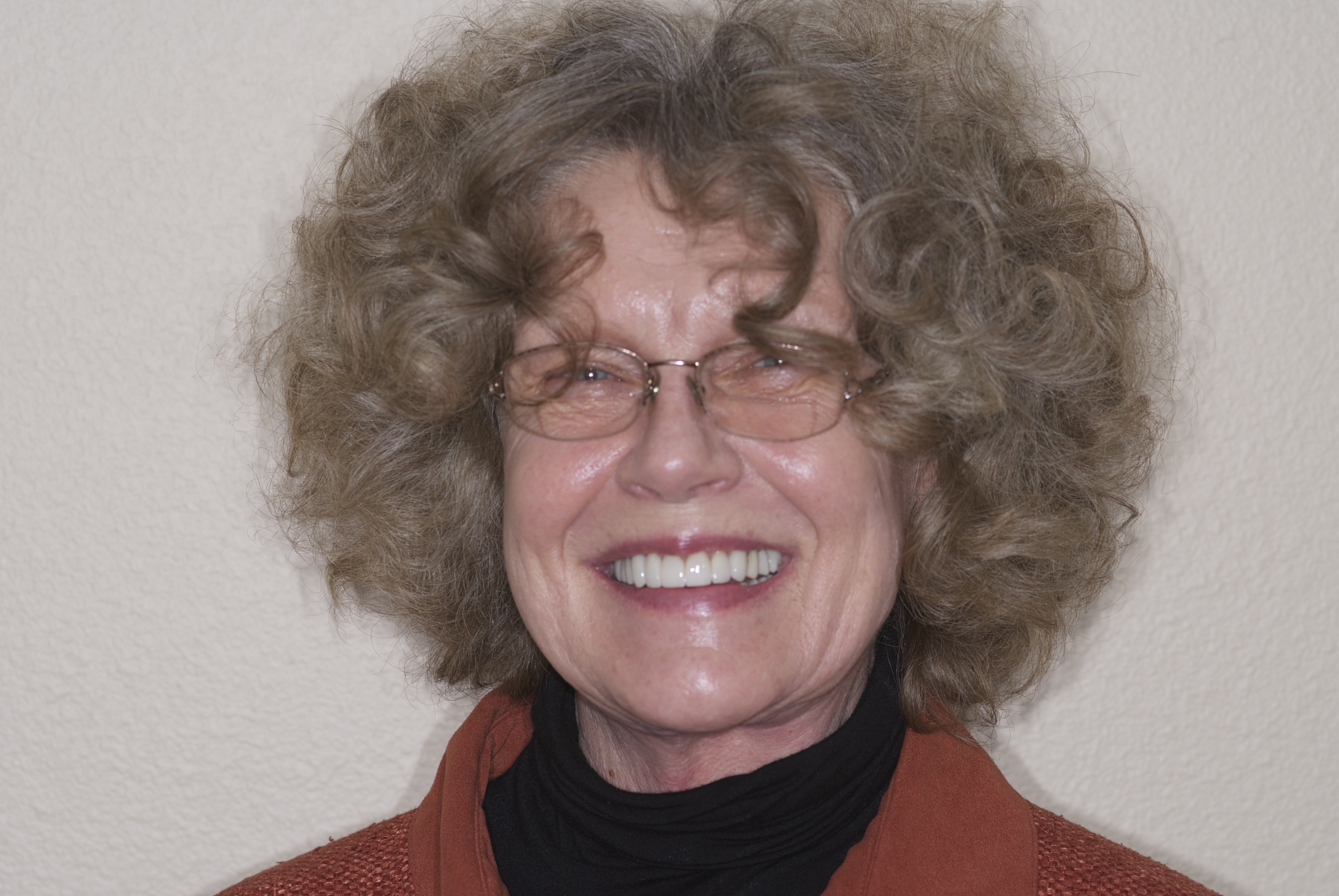 Patient smile after dental implant treatment