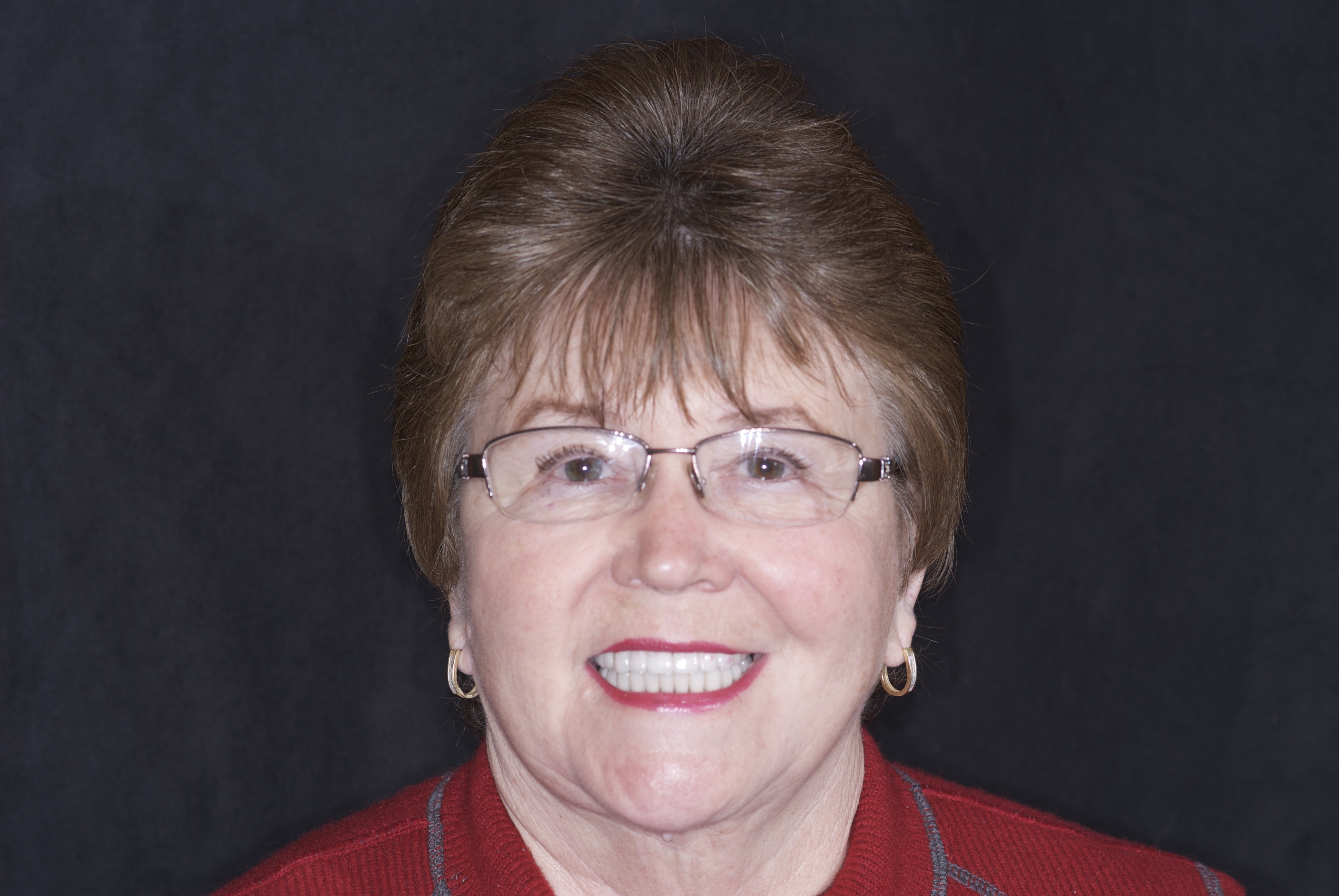 Patient smile after dental implant treatment