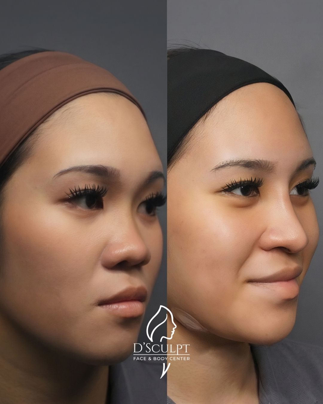 Sculpted progress