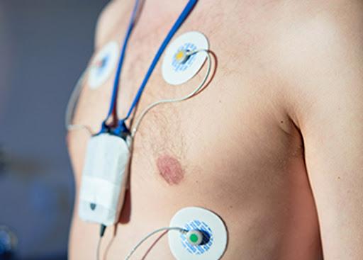 Electrocardiograma o Holter de 24 horas: ¿cuál es la diferencia y cuándo se necesita cada uno?
