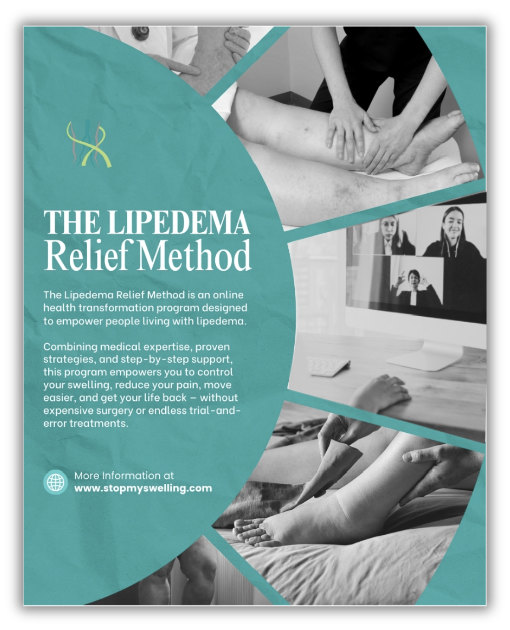 The Lipedema Relief Method