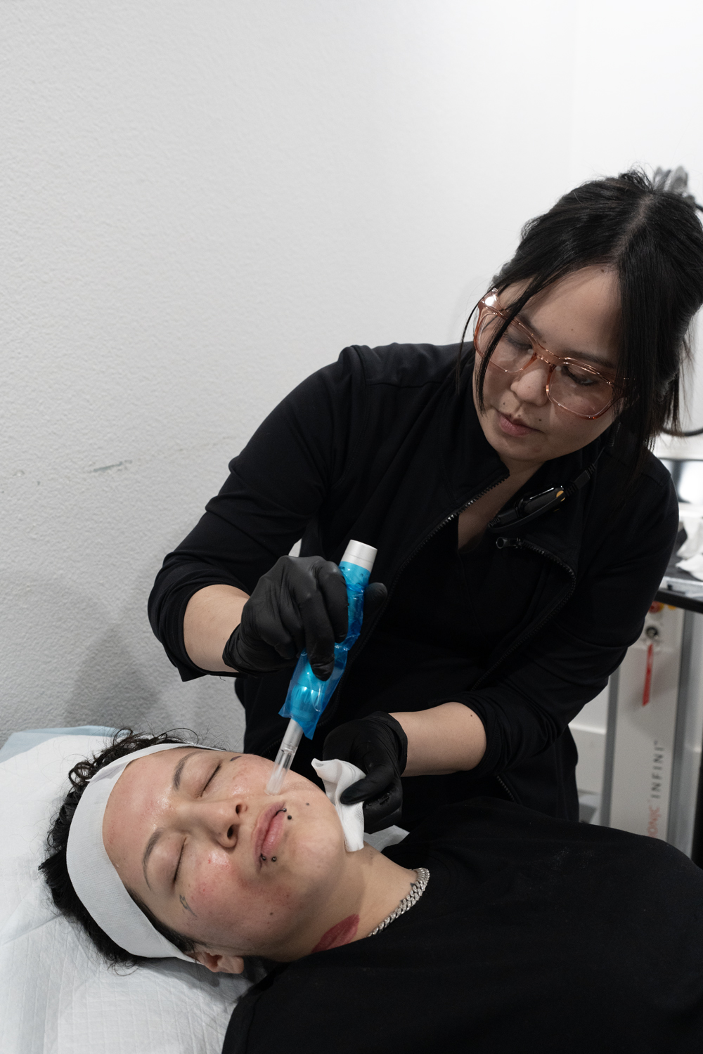 Is microneedling right for you — LeVogue Med Spa Temecula