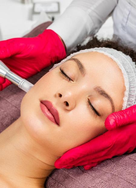 Woman receiving microneedling treatment for skin rejuvenation.