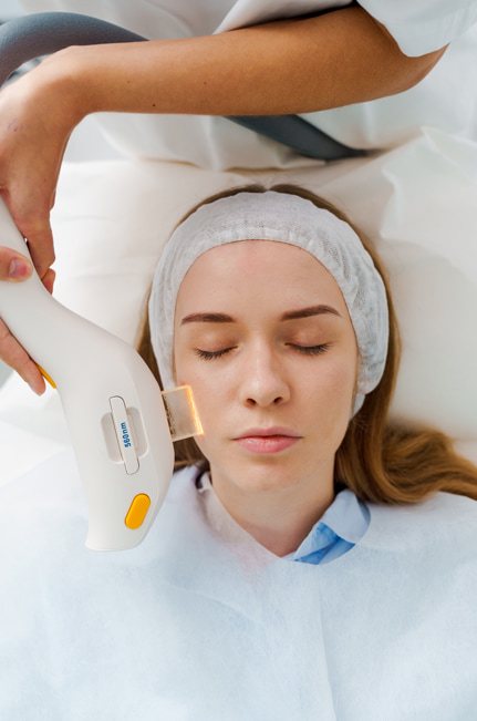 A patient receiving BBL skin treatment at LeVogue Med Spa in Temecula, targeting skin rejuvenation and reducing sunspots.