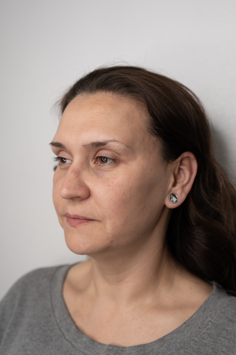 Beautiful natural dermal filler results — LeVogue Med Spa
