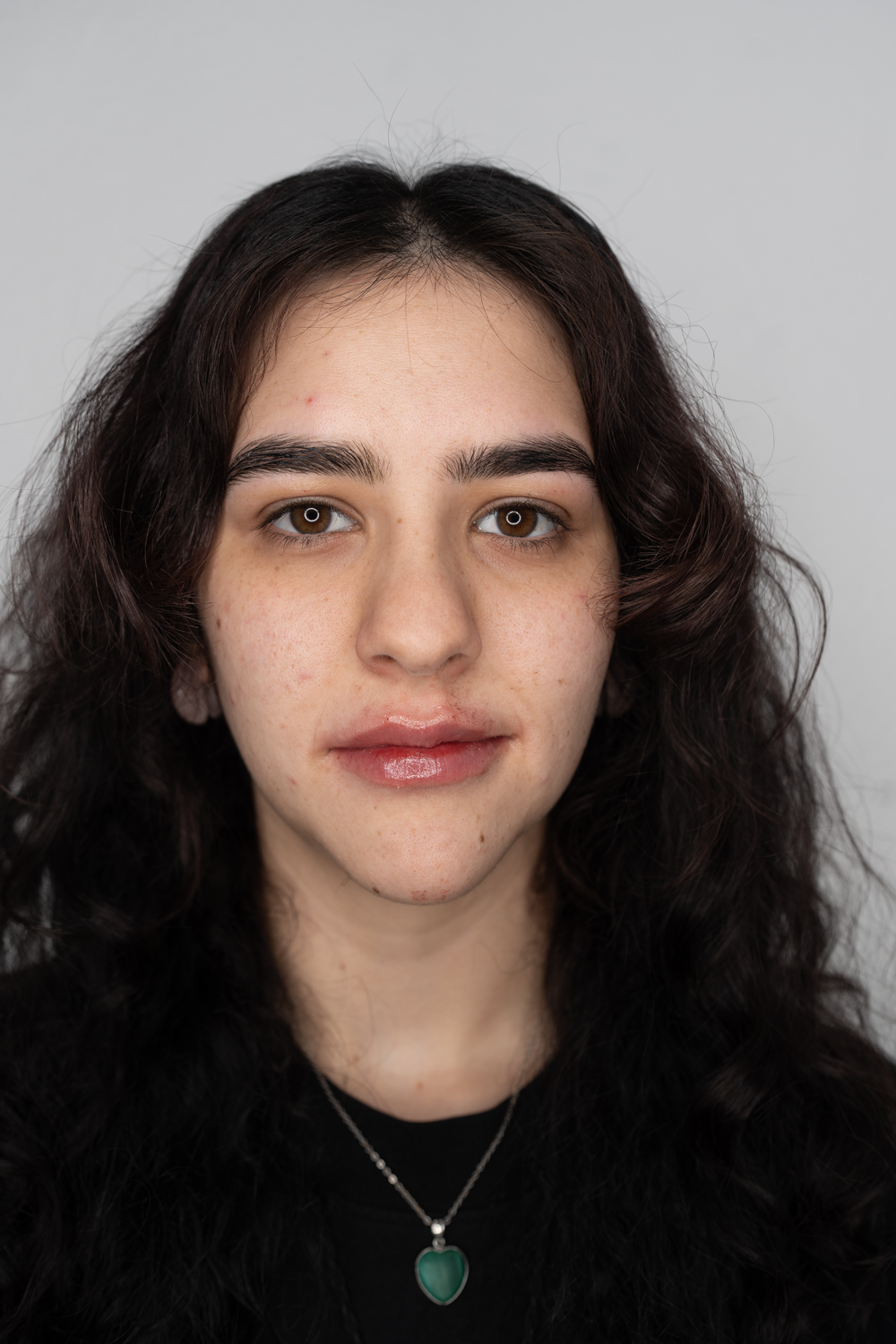 Beautiful natural dermal filler results, LeVogue Med Spa
