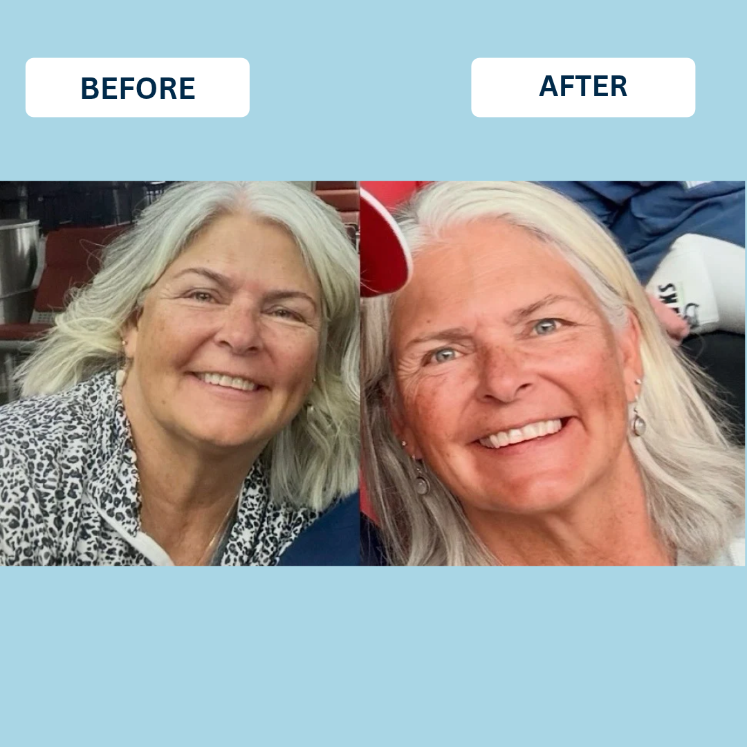 Rachele Lorentzen — transformation