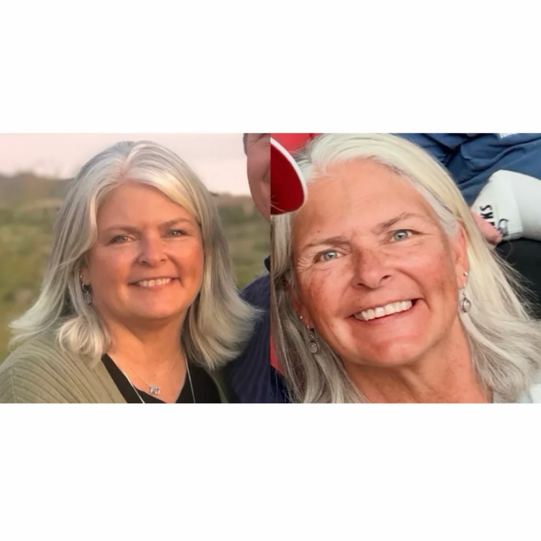 Transformation