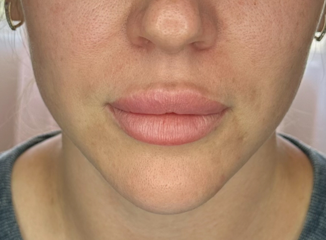 Before image