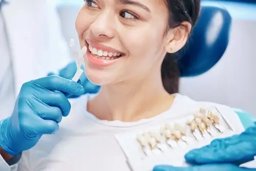 Your Veneers Consultation