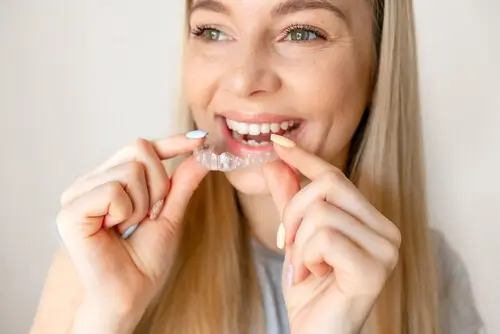 Dental Veneers