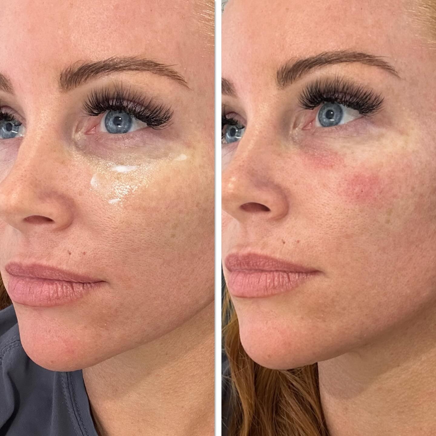 Client result 05
