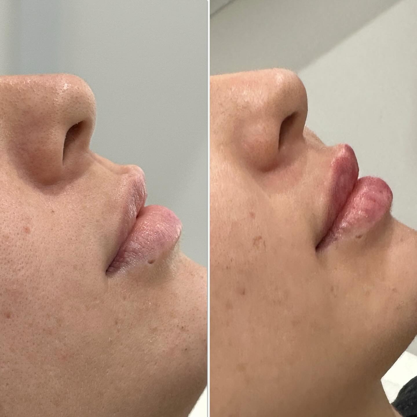 Client result 06