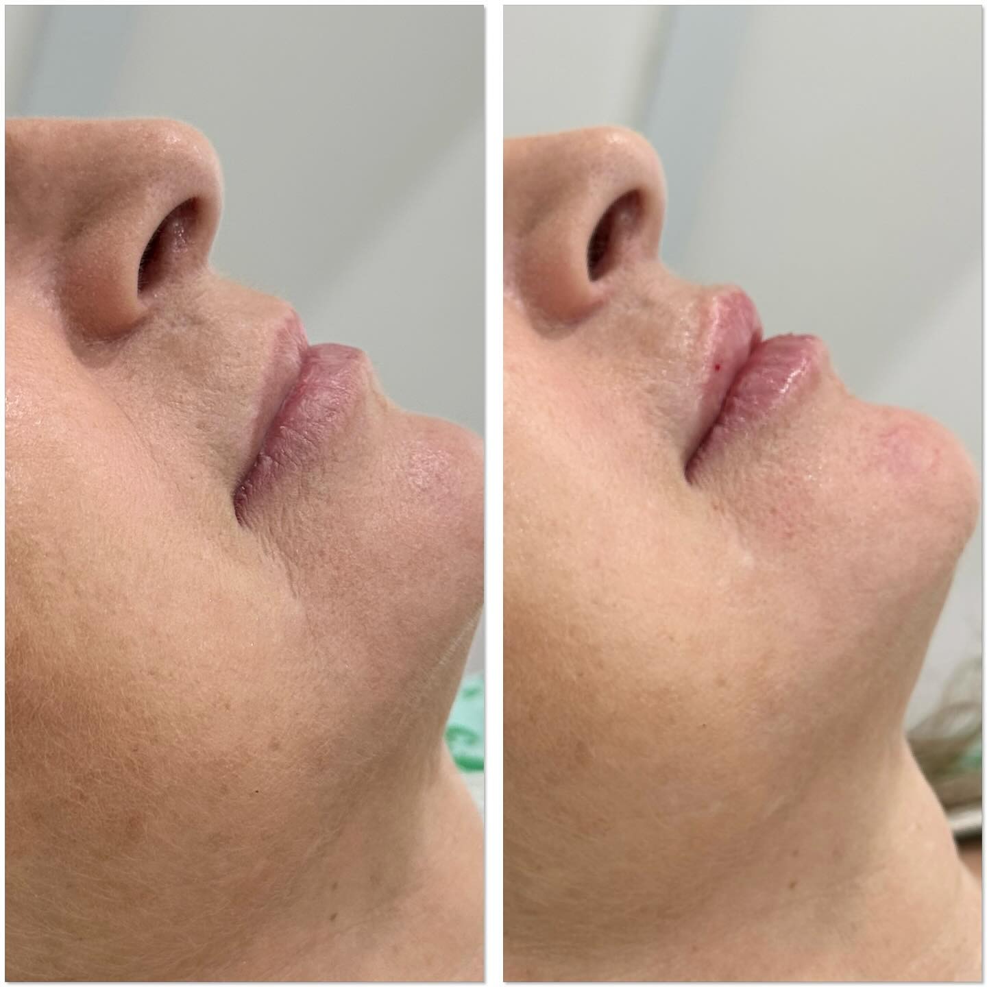 Client result 07