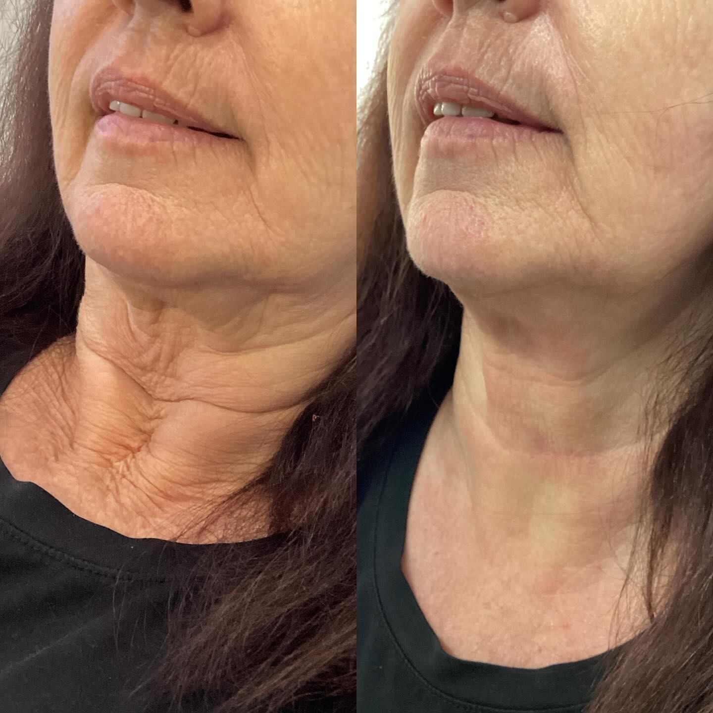 Client result 09